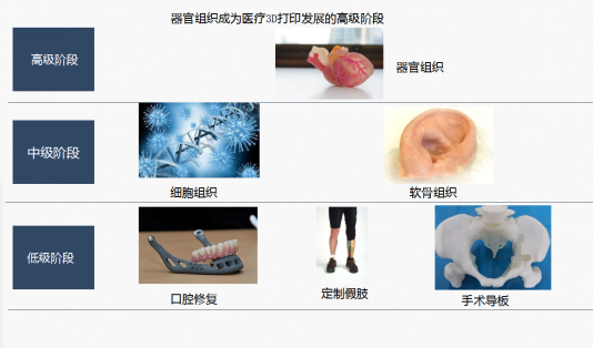 预计2022年全球医疗3D打印市场规模将达到89亿美元