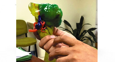 3D打印出一个肾而机器人手臂直接操刀把瘤子给切了